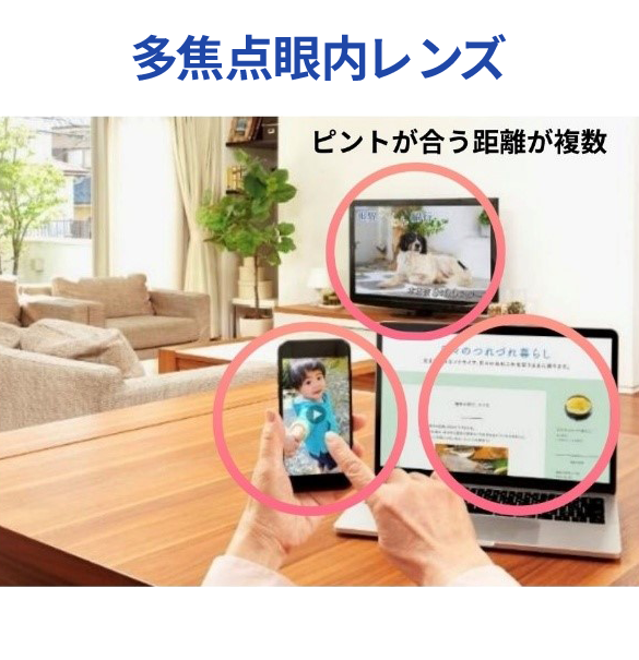 多焦点眼内レンズ